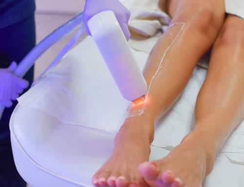 Laser Hair Removal- The Need to Know Before Treatment