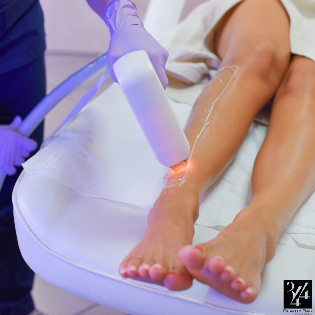 Laser Hair Removal The Need to Know Before Treatment 344 Beauty Bar